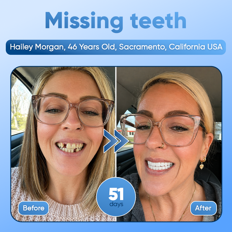 Your Smile😁Tideglusib Fast‑Dissolving Tooth & Gum Repair Oral Strips🦷✨ (𝟓-𝐢𝐧-𝟏 💎 𝐑𝐞𝐛𝐮𝐢𝐥𝐝 𝐄𝐧𝐚𝐦𝐞𝐥 & 𝐃𝐞𝐧𝐭𝐢𝐧 • 𝐒𝐭𝐫𝐞𝐧𝐠𝐭𝐡𝐞𝐧 𝐆𝐮𝐦𝐬 • 𝐄𝐫𝐚𝐝𝐢𝐜𝐚𝐭𝐞 𝐓𝐚𝐫𝐭𝐚𝐫 & 𝐎𝐝𝐨𝐫 • 𝐖𝐡𝐢𝐭𝐞𝐧𝐢𝐧𝐠 • 𝐒𝐭𝐨𝐩 𝐓𝐨𝐨𝐭𝐡 𝐒𝐞𝐧𝐬𝐢𝐭𝐢𝐯𝐢𝐭𝐲)