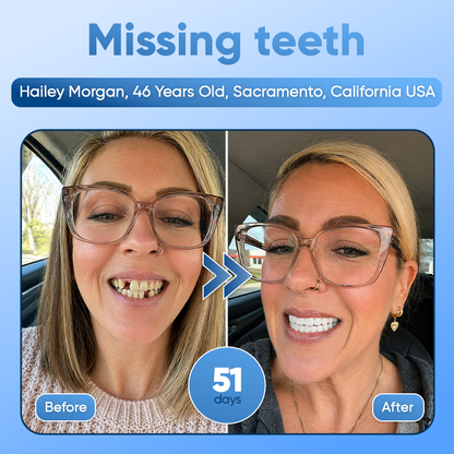 Your Smile😁Tideglusib Fast‑Dissolving Tooth & Gum Repair Oral Strips🦷✨ (𝟓-𝐢𝐧-𝟏 💎 𝐑𝐞𝐛𝐮𝐢𝐥𝐝 𝐄𝐧𝐚𝐦𝐞𝐥 & 𝐃𝐞𝐧𝐭𝐢𝐧 • 𝐒𝐭𝐫𝐞𝐧𝐠𝐭𝐡𝐞𝐧 𝐆𝐮𝐦𝐬 • 𝐄𝐫𝐚𝐝𝐢𝐜𝐚𝐭𝐞 𝐓𝐚𝐫𝐭𝐚𝐫 & 𝐎𝐝𝐨𝐫 • 𝐖𝐡𝐢𝐭𝐞𝐧𝐢𝐧𝐠 • 𝐒𝐭𝐨𝐩 𝐓𝐨𝐨𝐭𝐡 𝐒𝐞𝐧𝐬𝐢𝐭𝐢𝐯𝐢𝐭𝐲)