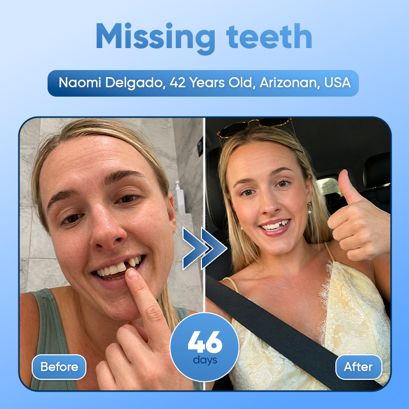 Your Smile😁Tideglusib Fast‑Dissolving Tooth & Gum Repair Oral Strips🦷✨ (𝟓-𝐢𝐧-𝟏 💎 𝐑𝐞𝐛𝐮𝐢𝐥𝐝 𝐄𝐧𝐚𝐦𝐞𝐥 & 𝐃𝐞𝐧𝐭𝐢𝐧 • 𝐒𝐭𝐫𝐞𝐧𝐠𝐭𝐡𝐞𝐧 𝐆𝐮𝐦𝐬 • 𝐄𝐫𝐚𝐝𝐢𝐜𝐚𝐭𝐞 𝐓𝐚𝐫𝐭𝐚𝐫 & 𝐎𝐝𝐨𝐫 • 𝐖𝐡𝐢𝐭𝐞𝐧𝐢𝐧𝐠 • 𝐒𝐭𝐨𝐩 𝐓𝐨𝐨𝐭𝐡 𝐒𝐞𝐧𝐬𝐢𝐭𝐢𝐯𝐢𝐭𝐲)